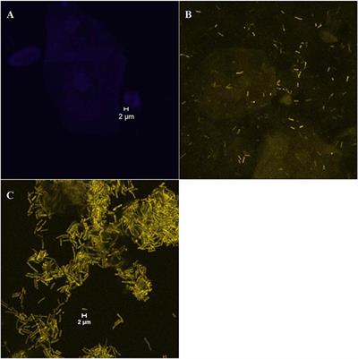 Growth Forms of Gardnerella spp. and Lactobacillus spp. on Vaginal Cells